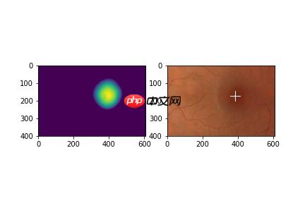 【飞桨常规赛】GAMMA中央凹检测 11月第2名方案 - php中文网