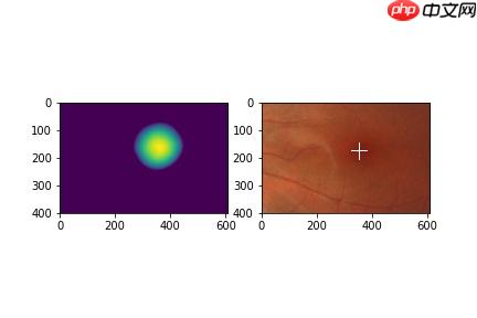 【飞桨常规赛】GAMMA中央凹检测 11月第2名方案 - php中文网