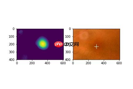 【飞桨常规赛】GAMMA中央凹检测 11月第2名方案 - php中文网