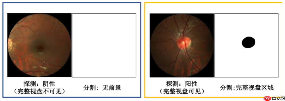 常规赛：PALM眼底彩照视盘探测与分割-8月第8名方案 - php中文网