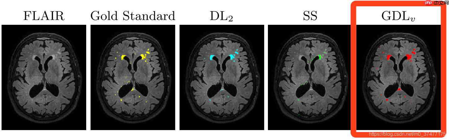 盘点图像分割中的损失函数 - php中文网