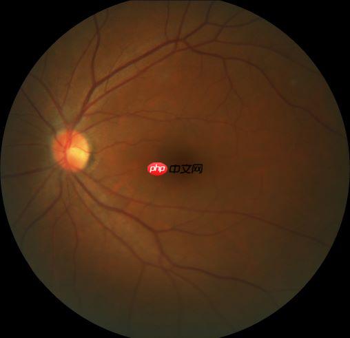 常规赛:PALM病理性近视预测 五月份第8名 - php中文网