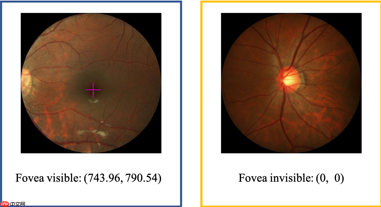 飞桨常规赛:黄斑中央凹定位(GAMMA挑战赛任务二) - 11月第3名方案 - php中文网