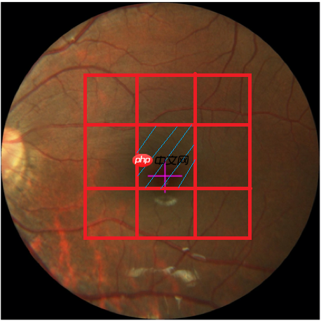 飞桨常规赛:黄斑中央凹定位(GAMMA挑战赛任务二) - 11月第3名方案 - php中文网