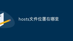 Where is the location of the hosts file?