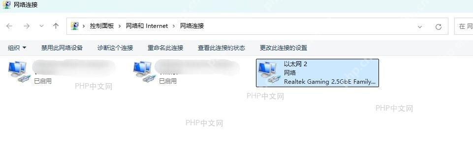 检查IP配置是否正确 - 确保自动获得IP地址和DNS服务器地址