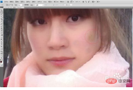 1569722119638842.png How to get rid of acne in ps2017