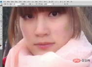 1569722114534027.png How to get rid of acne in ps2017