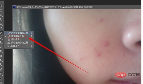How to use PS to remove acne on face