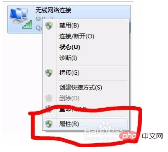 IPのDHCPを設定する方法