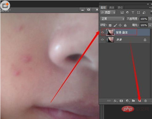 How to use PS to remove acne on face