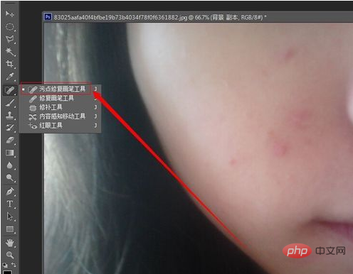 How to use PS to remove acne on face