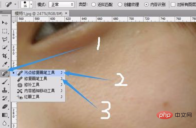 1565328394472844.png How to use PS to remove acne