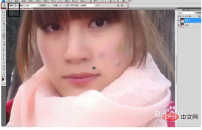 1569722099963295.png How to get rid of acne in ps2017