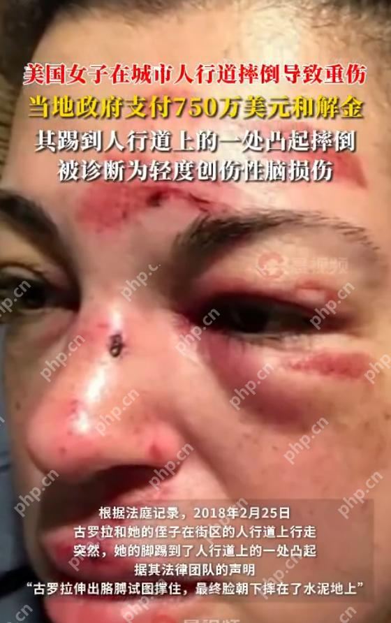 美国女子在人行道绊倒导致重伤:当地政府支付750万美元和解金 美国女子在人行道绊倒导致重伤:当地政府支付750万美元和解金