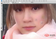 1569722109409964.png How to get rid of acne in ps2017